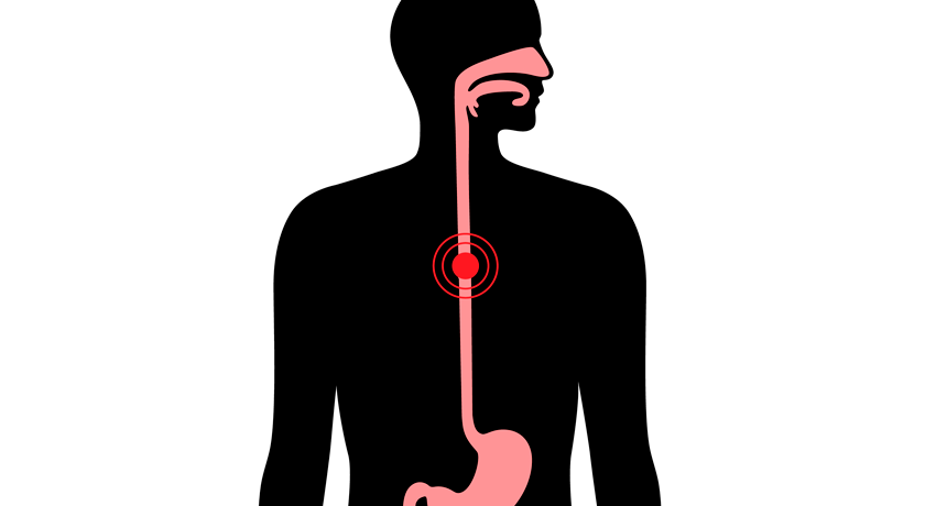 El TSJC acredita que el amianto es la causa del cáncer de esófago de un ex-trabajador de MACOSA